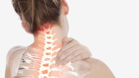Osteocondrose da columna cervical